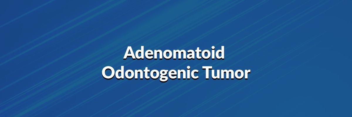 Adenomatoid Odontogenic Tumor
