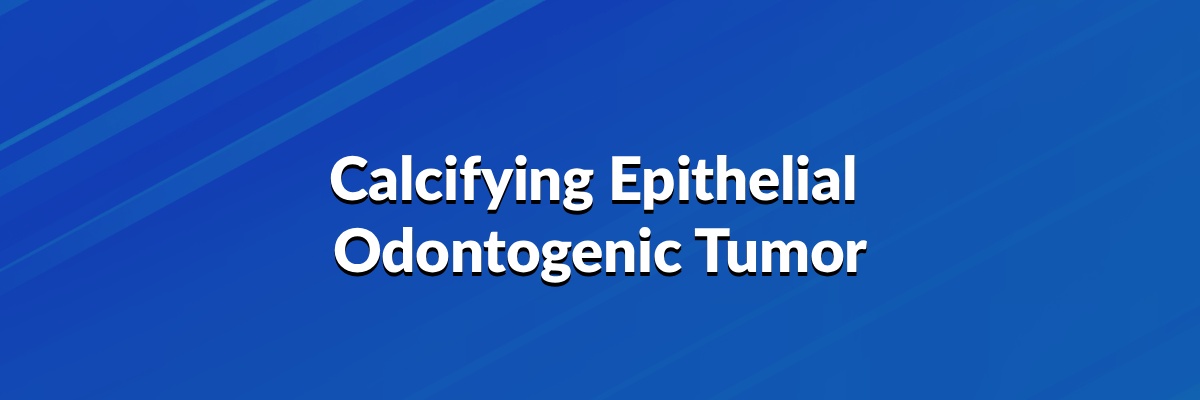 Calcifying Epithelial Odontogenic Tumor