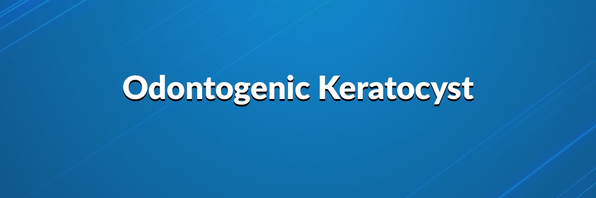 Odontogenic Keratocyst
