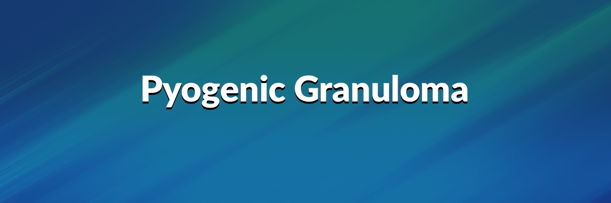 Pyogenic Granuloma