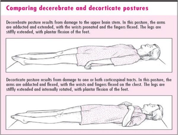 Glasgow Coma Score (GCS) - Dr. Paul Mirdamadi DDS