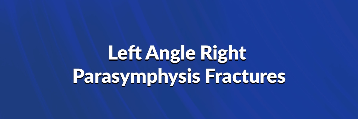 Left Angle & Right Parasymphysis Fractures