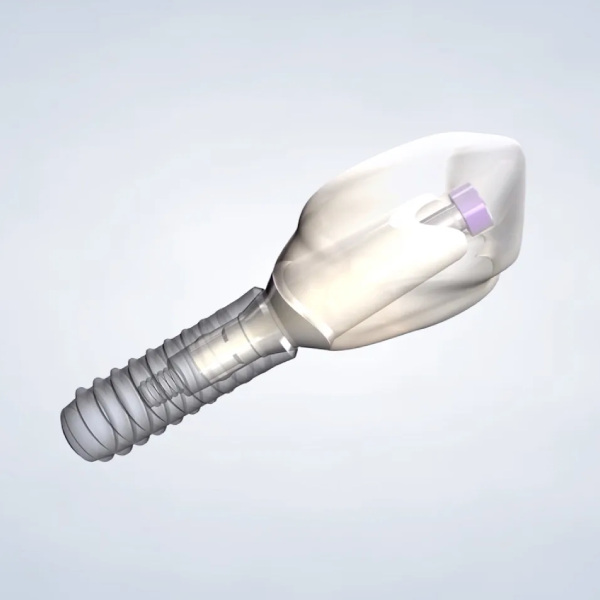 Single Dental Implant